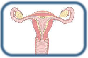 Rekanalisation nach Sterilisation